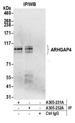 ARHGAP4 Antibody in Immunoprecipitation (IP)