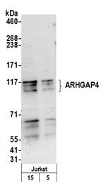 ARHGAP4 Antibody in Western Blot (WB)