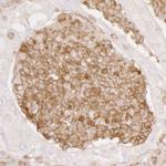 ANXA1/Annexin A1 Antibody in Immunohistochemistry (Paraffin) (IHC (P))