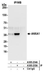 ANXA1/Annexin A1 Antibody in Immunoprecipitation (IP)