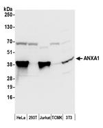 ANXA1/Annexin A1 Antibody in Western Blot (WB)