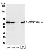 AHSG/Fetuin-A Antibody in Western Blot (WB)