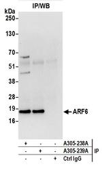 ARF6/ADP Ribosylation Factor 6 Antibody in Immunoprecipitation (IP)