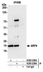 ARF6/ADP Ribosylation Factor 6 Antibody in Immunoprecipitation (IP)