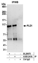 PLD1/Phospholipase D1 Antibody in Immunoprecipitation (IP)