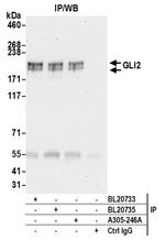 GLI2 Antibody in Immunoprecipitation (IP)