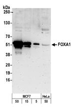 FOXA1/HNF3A Antibody in Western Blot (WB)