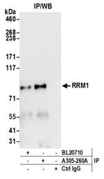 RRM1 Antibody in Immunoprecipitation (IP)