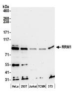 RRM1 Antibody in Western Blot (WB)