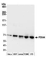 PDIA4/ERP72 Antibody in Western Blot (WB)