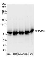 PDIA4/ERP72 Antibody in Western Blot (WB)