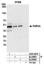 PARVA/Parvin alpha Antibody in Immunoprecipitation (IP)