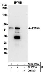 PRIM2/DNA Primase Large Subunit Antibody in Immunoprecipitation (IP)