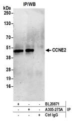 CCNE2/Cyclin E2 Antibody in Immunoprecipitation (IP)