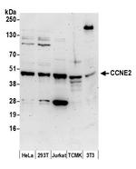 CCNE2/Cyclin E2 Antibody in Western Blot (WB)