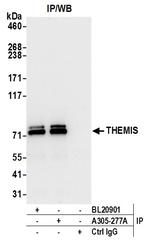 THEMIS Antibody in Immunoprecipitation (IP)