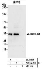 SUCLG1 Antibody in Immunoprecipitation (IP)