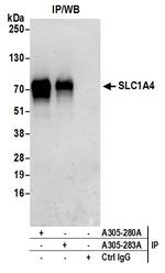 SLC1A4/ASCT1 Antibody in Immunoprecipitation (IP)