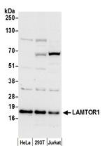 LAMTOR1 Antibody in Western Blot (WB)