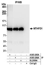 MTHFD1 Antibody in Immunoprecipitation (IP)