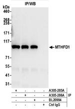 MTHFD1 Antibody in Immunoprecipitation (IP)