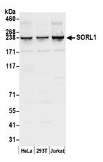 SORL1 Antibody in Western Blot (WB)