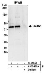 LMAN1 Antibody in Immunoprecipitation (IP)