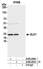 GLO1/Glyoxalase I Antibody in Immunoprecipitation (IP)