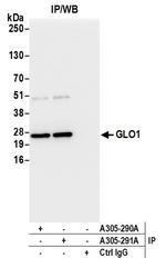 GLO1/Glyoxalase I Antibody in Immunoprecipitation (IP)