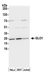 GLO1/Glyoxalase I Antibody in Western Blot (WB)