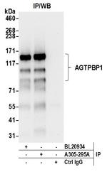 AGTPBP1 Antibody in Immunoprecipitation (IP)