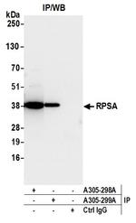 RPSA Antibody in Immunoprecipitation (IP)