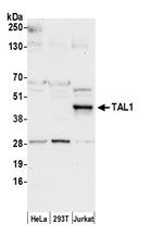 TAL1 Antibody in Western Blot (WB)