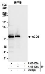 ACO2/Aconitase Antibody in Immunoprecipitation (IP)