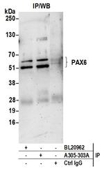 PAX6/AN Antibody in Immunoprecipitation (IP)