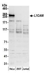 L1CAM/LI Antibody in Western Blot (WB)