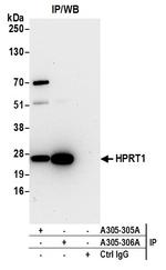 HPRT1 Antibody in Immunoprecipitation (IP)