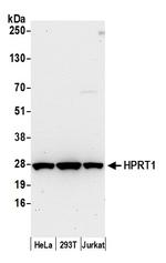 HPRT1 Antibody in Western Blot (WB)