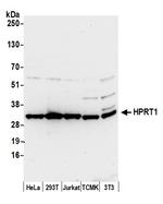 HPRT1 Antibody in Western Blot (WB)