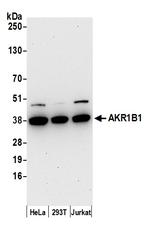 AKR1B1 Antibody in Western Blot (WB)