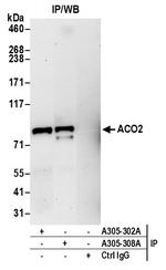 ACO2/Aconitase Antibody in Immunoprecipitation (IP)