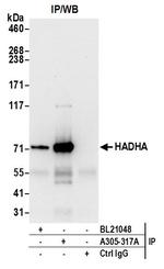 HADHA Antibody in Immunoprecipitation (IP)