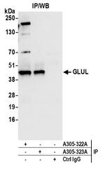 GLUL/Glutamine Synthetase Antibody in Immunoprecipitation (IP)