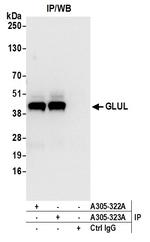 GLUL/Glutamine Synthetase Antibody in Immunoprecipitation (IP)