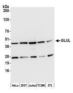 GLUL/Glutamine Synthetase Antibody in Western Blot (WB)