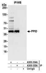 PPID Antibody in Immunoprecipitation (IP)