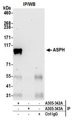 ASPH Antibody in Immunoprecipitation (IP)