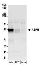 ASPH Antibody in Western Blot (WB)