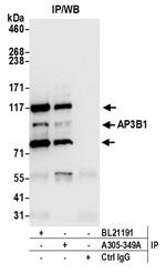 AP3B1 Antibody in Immunoprecipitation (IP)