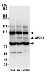 AP3B1 Antibody in Western Blot (WB)